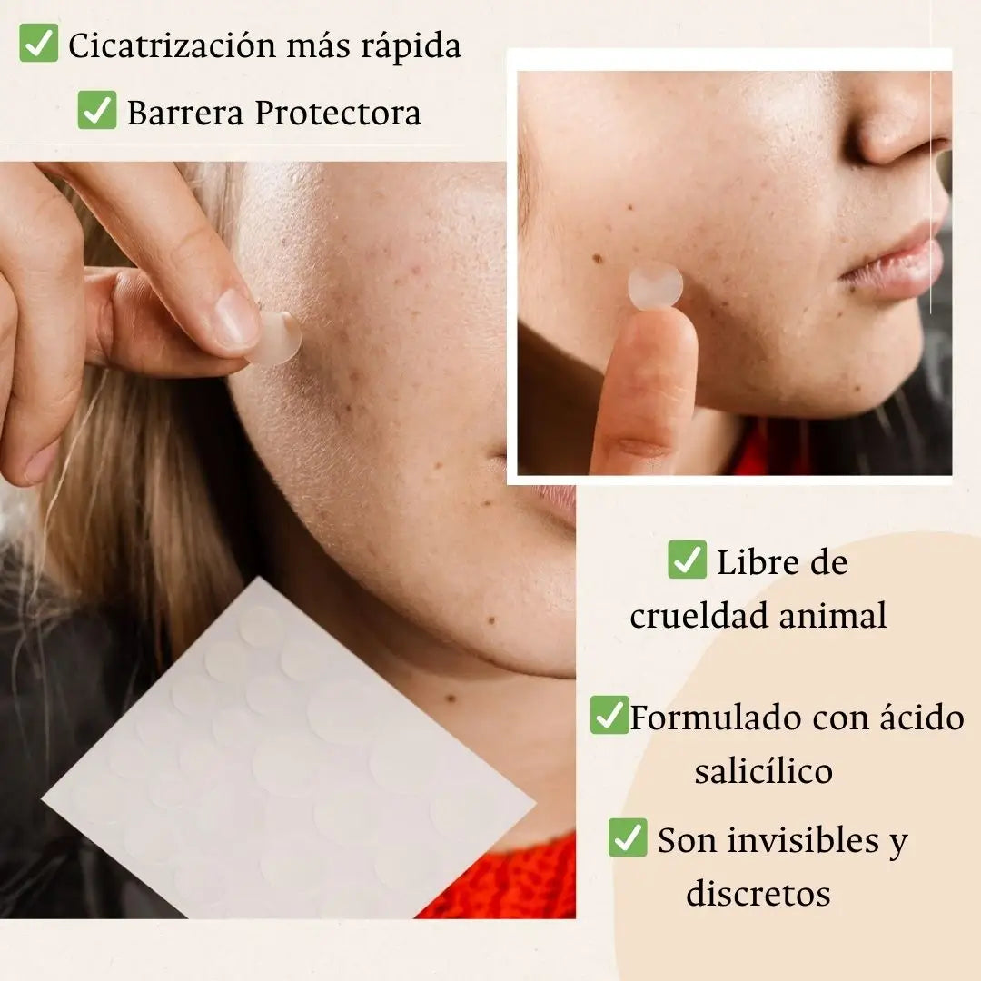 144 Parches Hidrocoloide Para Acne®
